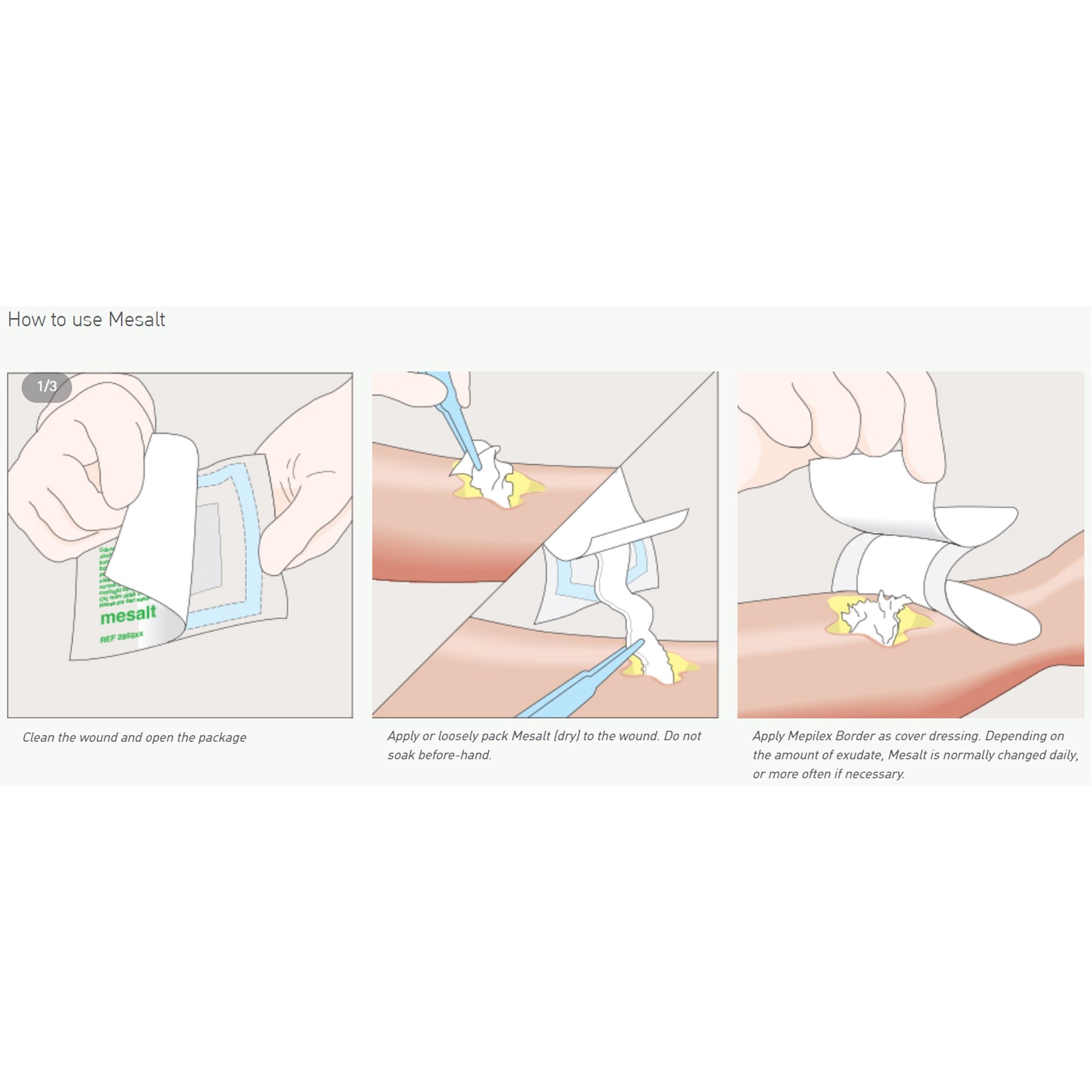 Mesalt® Sodium Chloride Impregnated Dressing, 8 x 8 Inch
