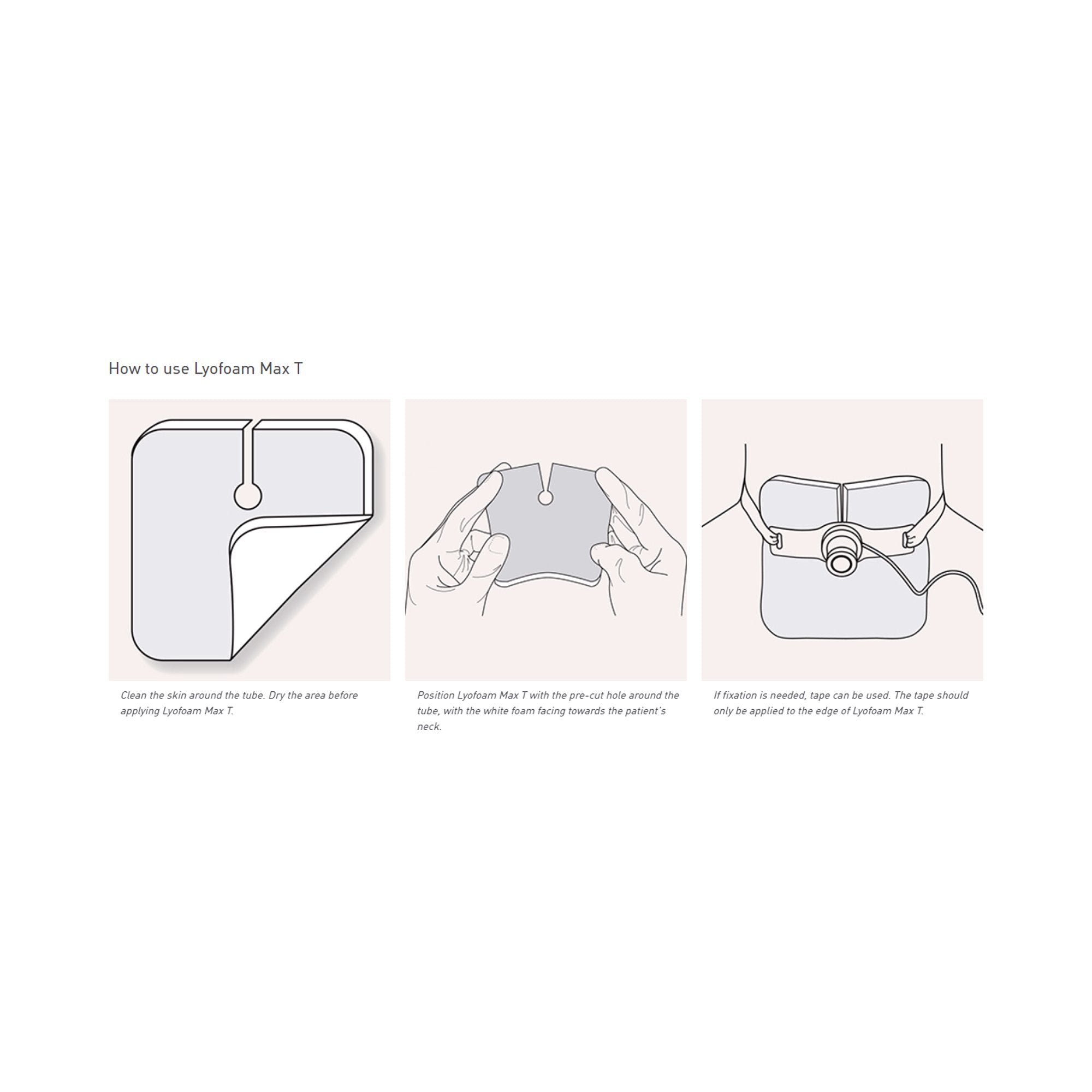 Lyofoam® Max T Nonadhesive without Border Foam Dressing, 3Â½ x 3Â½ Inch